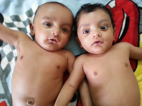 Lucky Are Those Who Have Twins